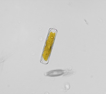 Diatom